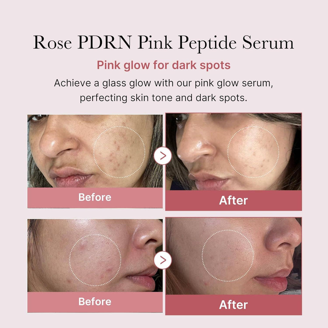 MEDICUBE PDRN Pink Peptide Serum 30ML (LH)